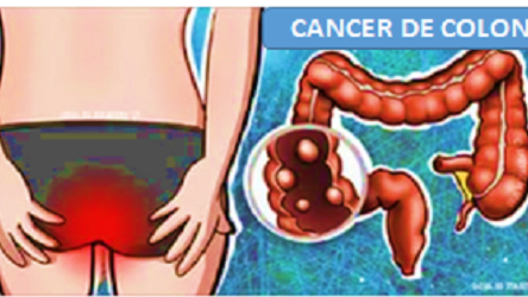 LA TASA DE CÁNCER AUMENTA, Síntomas Que Debe Tomar En Serio.
