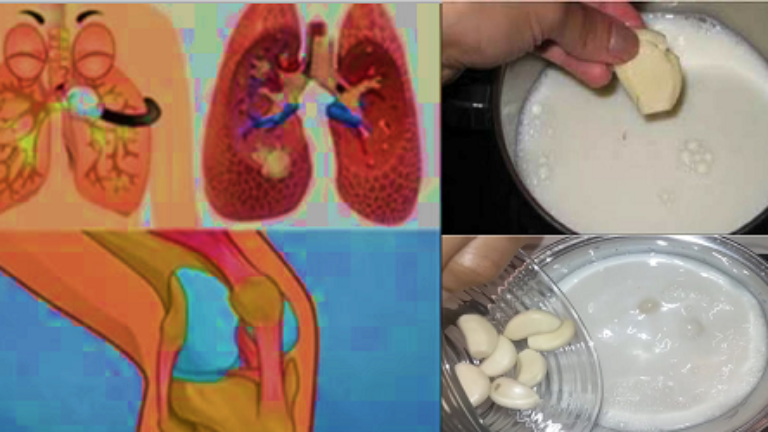 El Ajo en LEche son la Cura